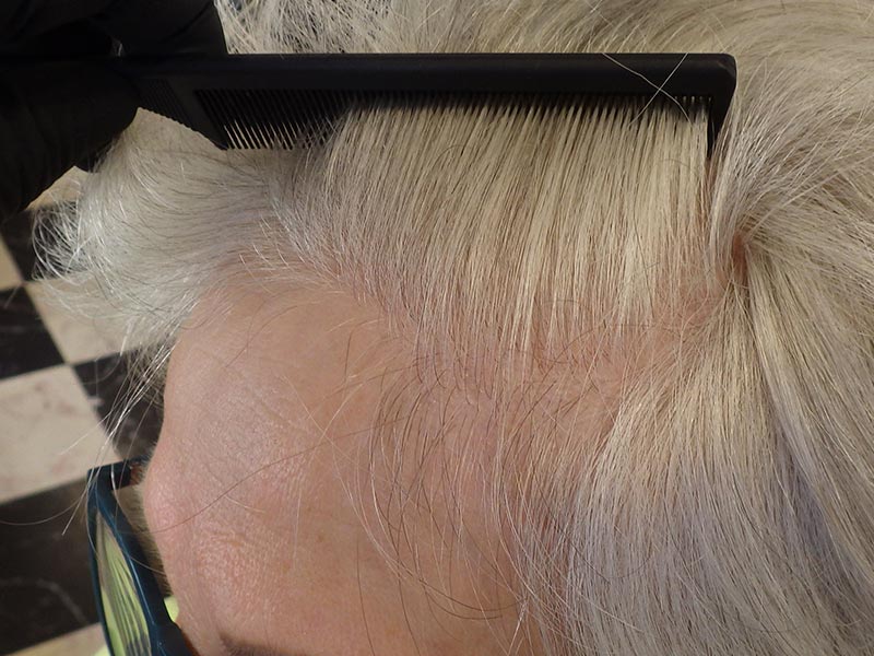 Naissance De Nouveau Cheveux