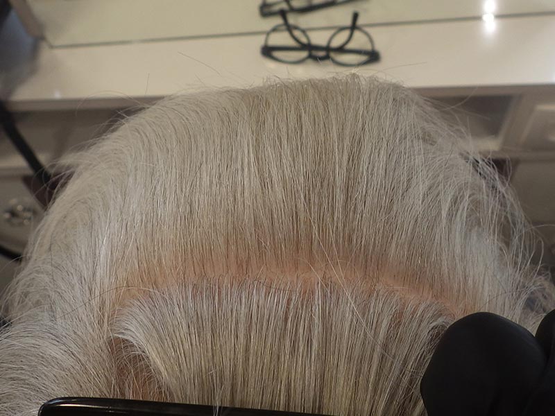 Naissance De Nouveau Cheveux